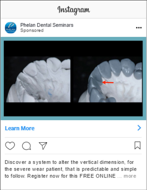 Phelan Dental Paid Instagram Ad #1